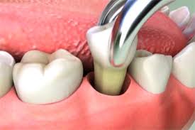 Perawatan Basic Audy Dental