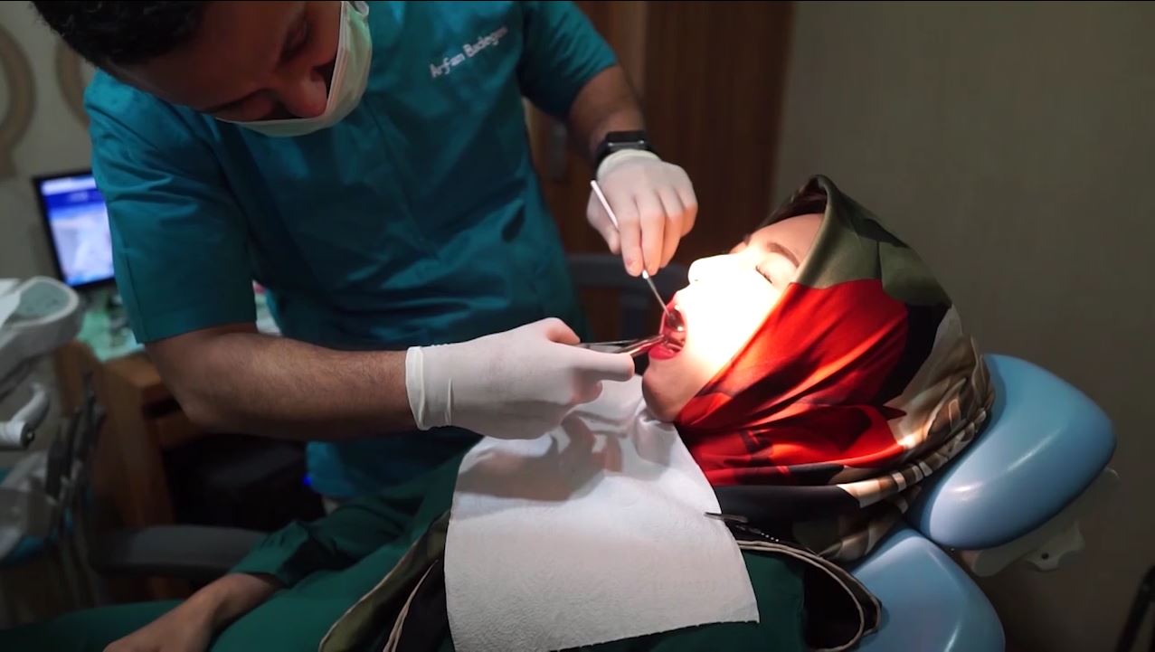 Operasi Gigi Bungsu Audy Dental