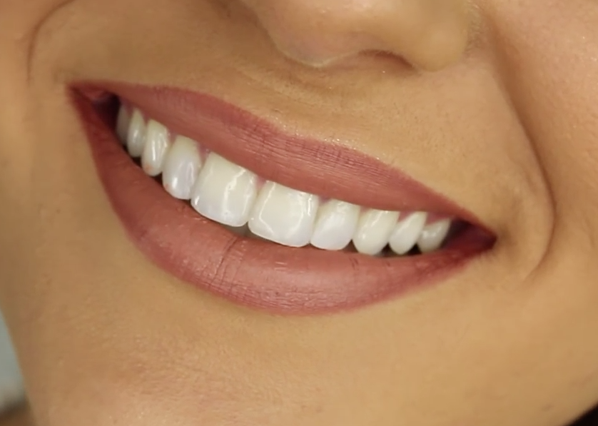 gigi putih audy dental