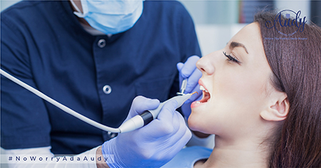 scaling gigi audy dental