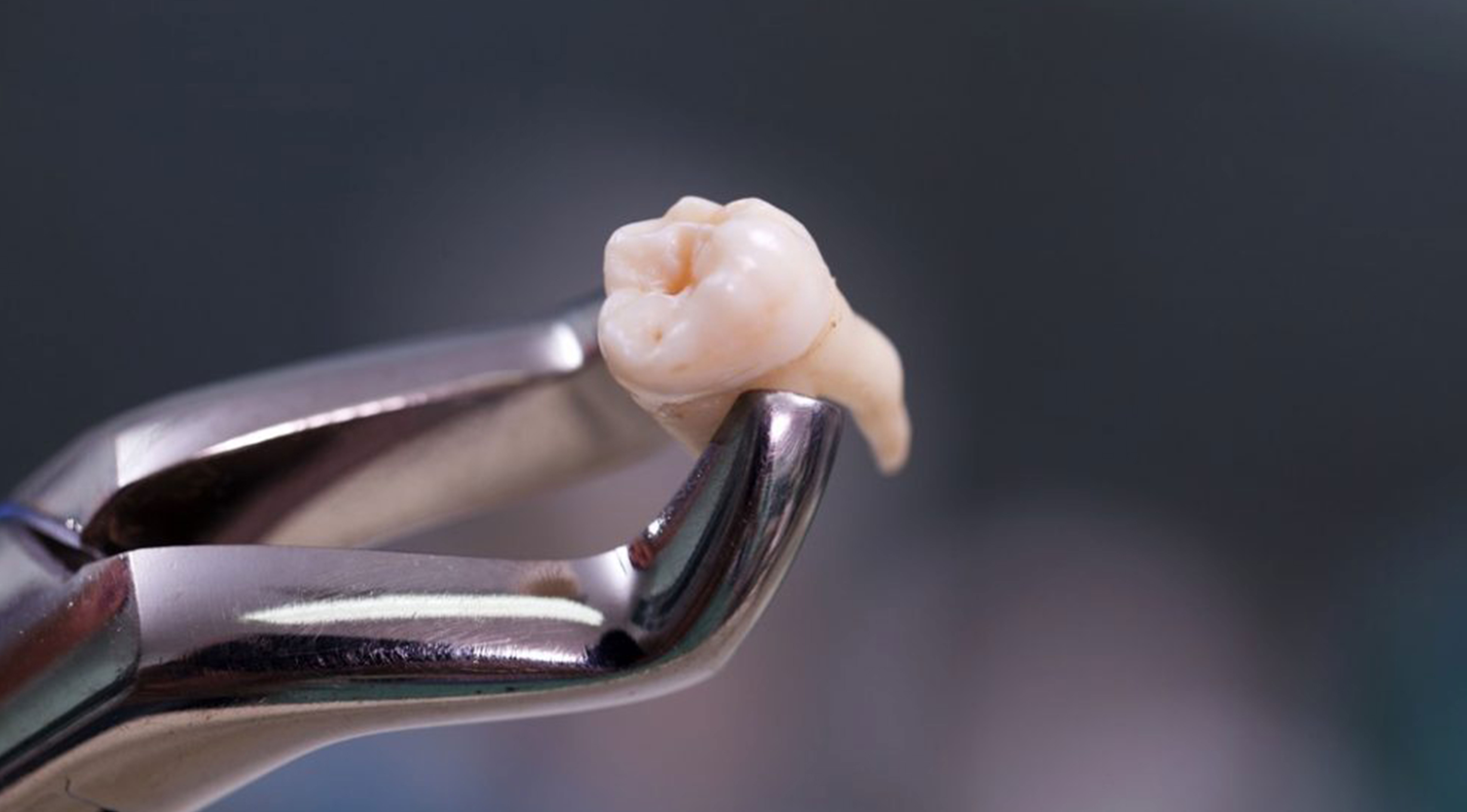 Закаленный зуб