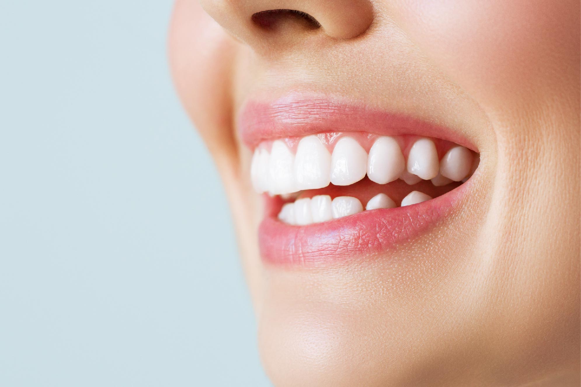 Manfaat Veneer Gigi dan Efek Samping